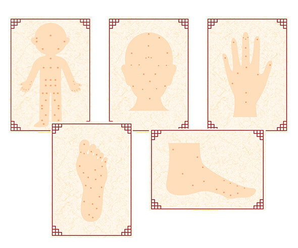 한의원 혈자리 포스터