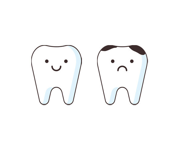 치아, 썩은 치아