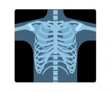 몸통 엑스레이 사진