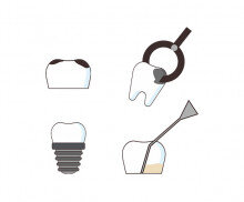 치과 치료 아이콘